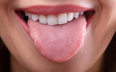 ¿Por qué debemos limpiar correctamente la lengua?