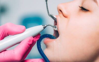 La importancia de hacerte una limpieza dental