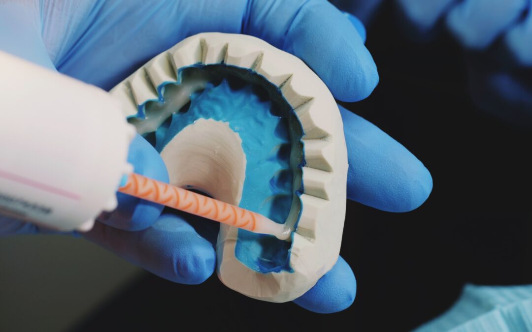 Pegamento dental: ¿cómo se usa? - Centre Dental Puig&Baldrich